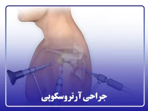 جراحی آرتروسکوپی