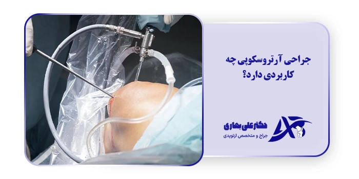 جراحی آرتروسکوپی چه کاربردی دارد؟