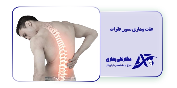 علت بیماری ستون فقرات