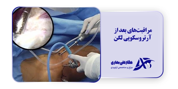 مراقبت های بعد از آرتروسکوپی لگن