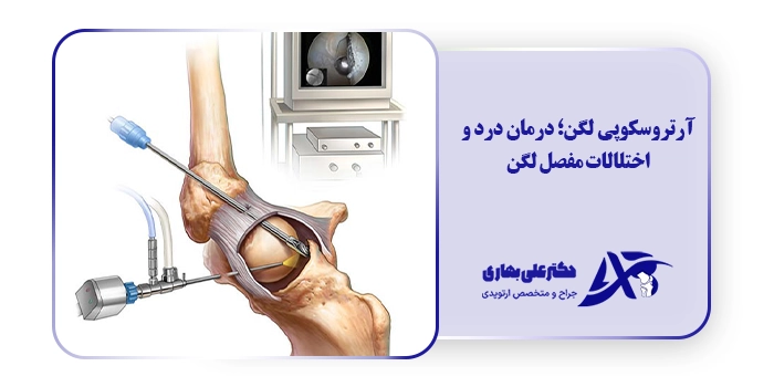 آرتروسکوپی لگن؛ درمان درد و اختلالات مفصل لگن
