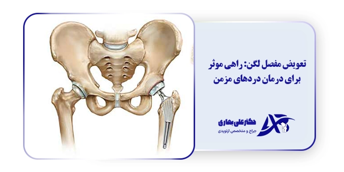 تعویض مفصل لگن: راهی موثر برای درمان دردهای مزمن