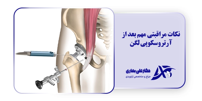 نکات مراقبتی مهم بعد از آرتروسکوپی لگن