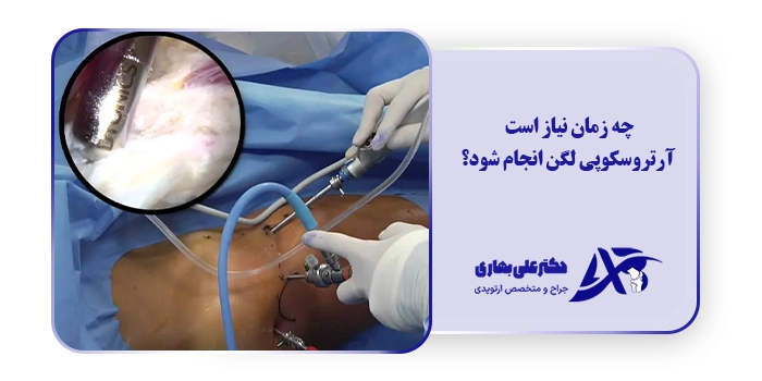 چه زمان نیاز است آرتروسکوپی لگن انجام شود؟
