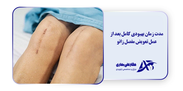 مدت زمان بهبودی کامل بعد از عمل تعویض مفصل زانو