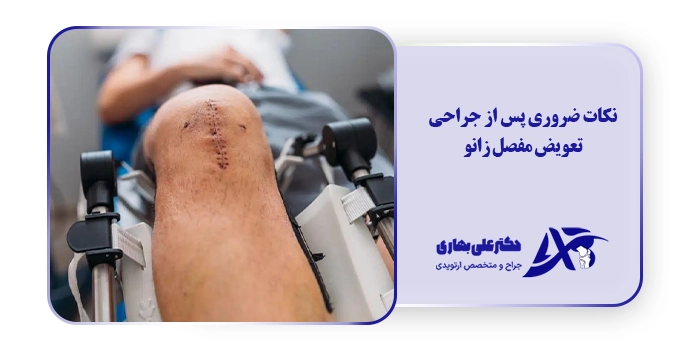 نکات ضروری پس از جراحی تعویض مفصل زانو