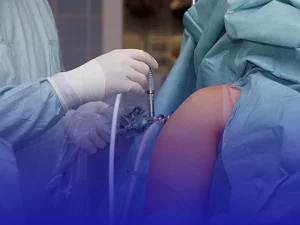 هزینه جراحی آرتروسکوپی شانه