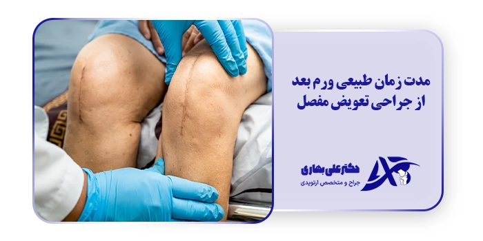 مدت زمان طبیعی ورم بعد از جراحی تعویض مفصل زانو