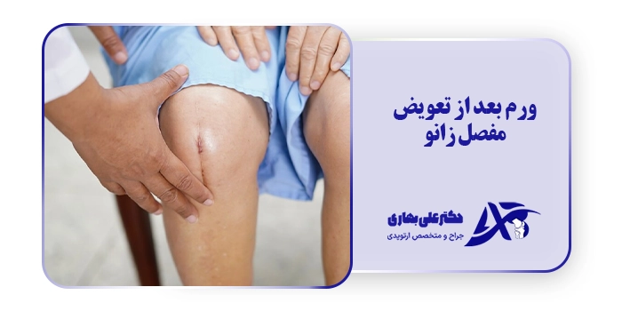 ورم بعد از تعویض مفصل زانو