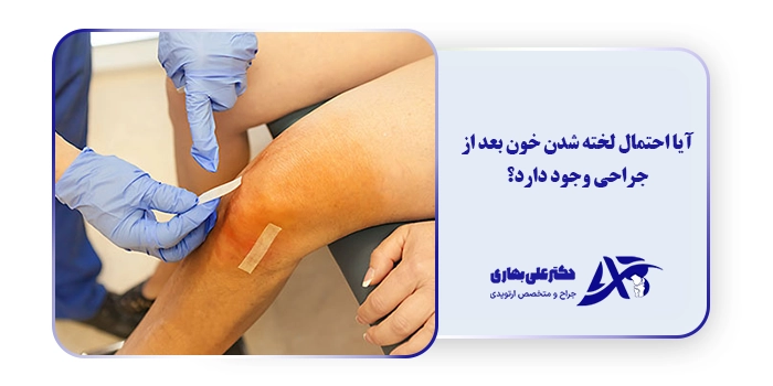 آیا احتمال لخته شدن خون بعد از جراحی وجود دارد؟
