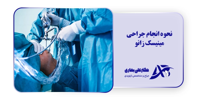 نحوه انجام جراحی مینیسک زانو