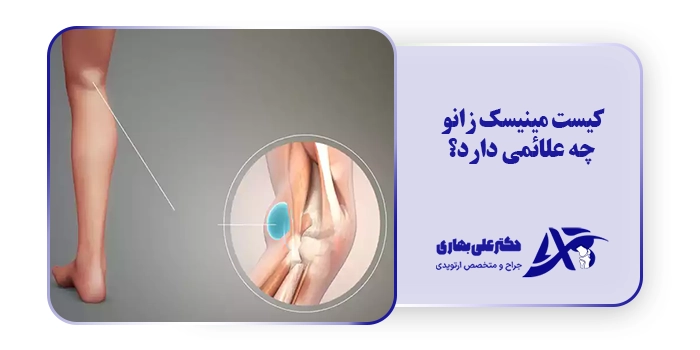 کیست مینیسک زانو چه علائمی دارد؟