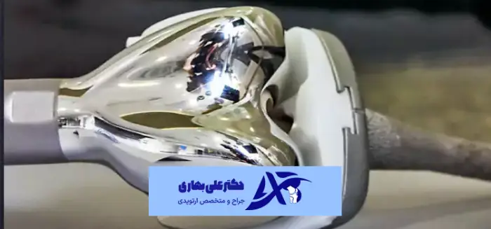 میانگین طول عمر پروتز زانو چقدر است؟