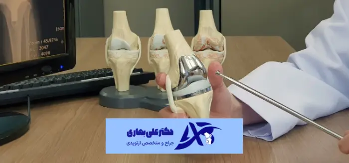 علائم پایان عمر مفید پروتز زانو چیست؟