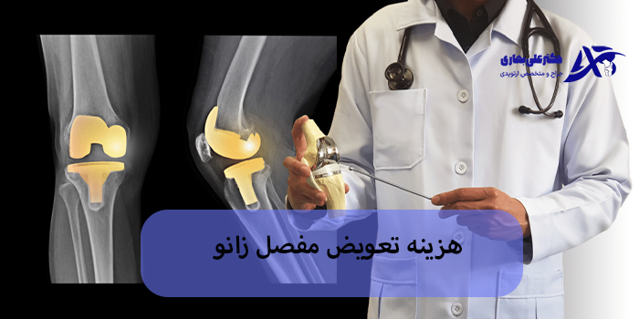 نکات مهم برای کاهش هزینه تعویض مفصل زانو