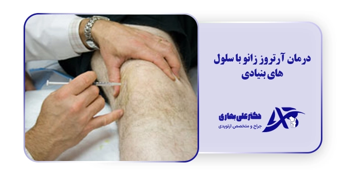 درمان آرتروز زانو با سلول های بنیادی