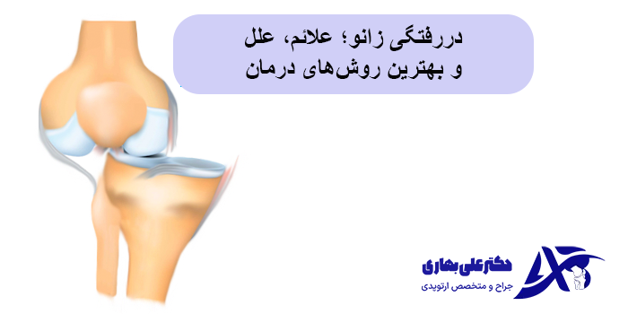 دررفتگی زانو؛ علائم، علل و بهترین روشهای درمان