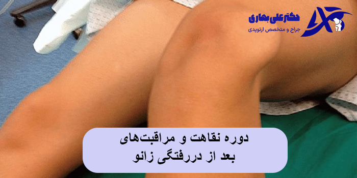دوره نقاهت و مراقبتهای بعد از دررفتگی زانو