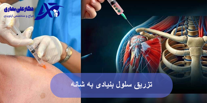 تزریق سلول بنیادی به شانه