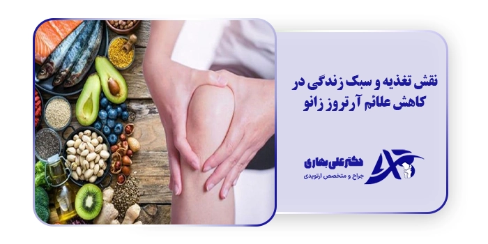 نقش تغذیه و سبک زندگی در کاهش علائم آرتروز زانو