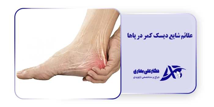 علائم شایع دیسک کمر در پاها