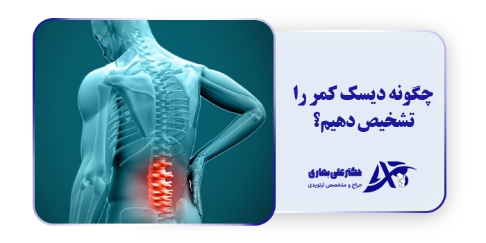 چگونه دیسک کمر را تشخیص دهیم؟