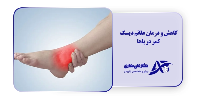 کاهش و درمان علائم دیسک کمر در پاها