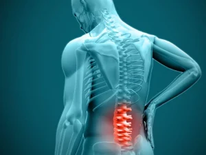 آیا دیسک کمر خوب میشود؟
