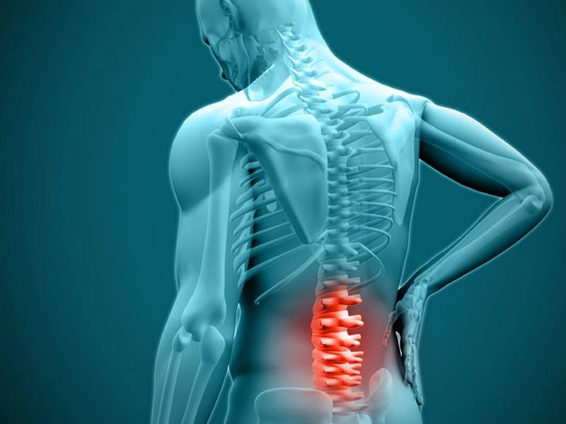 آیا دیسک کمر خوب می‌شود؟