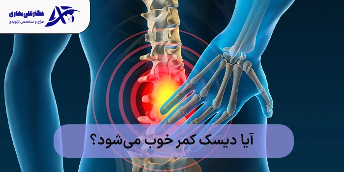 آیا دیسک کمر خوب میشود؟
