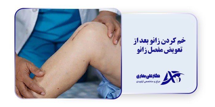 خم کردن زانو بعد از تعویض مفصل زانو