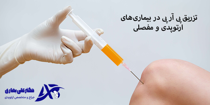 تزریق پی آر پی + مزایا، ماندگاری و هزینه