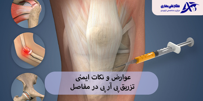 عوارض و نکات ایمنی تزریق پی آر پی در مفاصل