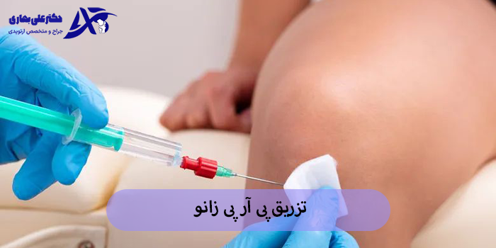 پی آر پی زانو